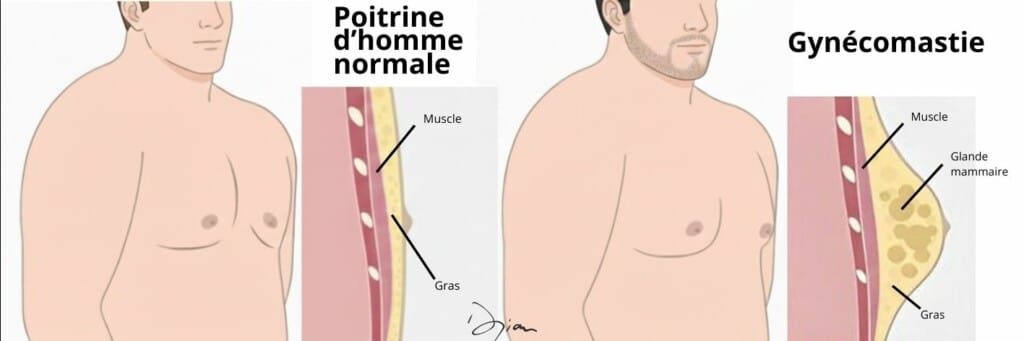 Anatomie Gynécomastie