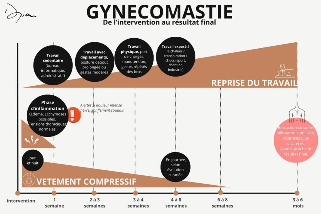 Gynécomastie Jour J au résultat final