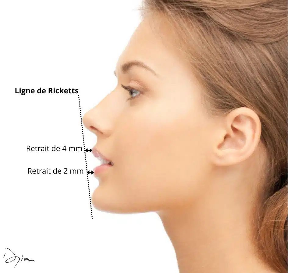 Ligne de Riketts Visage de femme de profil idéal