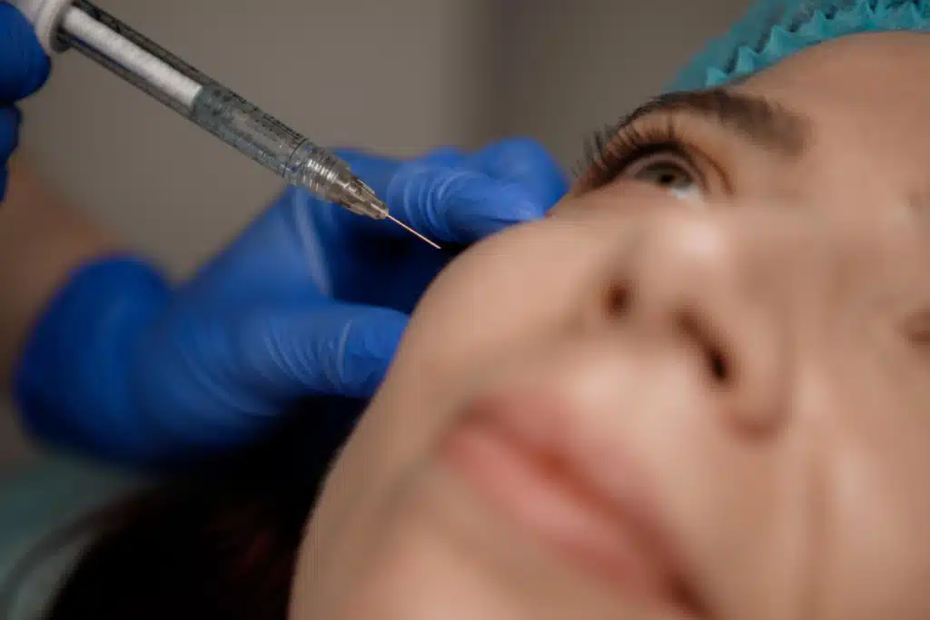 Injection cernes a l'acide hyaluronique