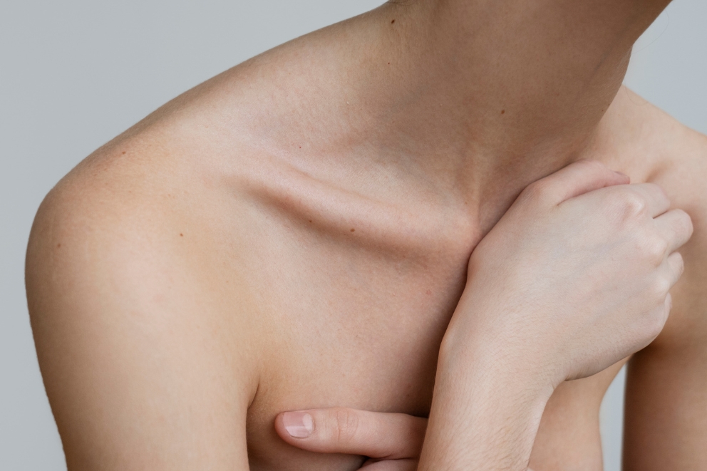 Voir Seins tubéreux