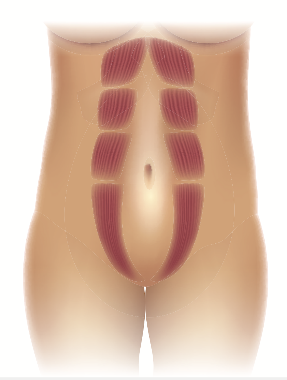 Diastasis & abdominoplastie : chirurgie réparatrice ventre ...