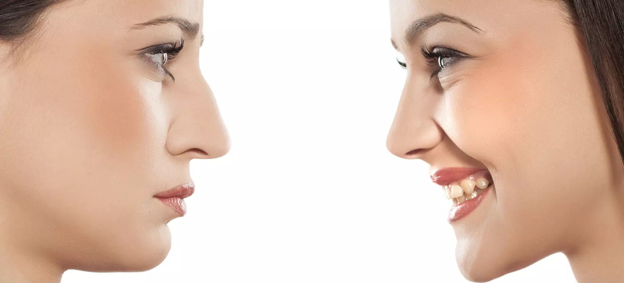 Rhinoplastie prix : combien coûte une chirurgie esthétique du nez ?