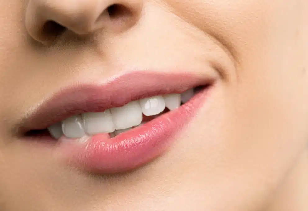 Voir LIP LIFT à PARIS - LIFTING LÈVRE SUPÉRIEURE