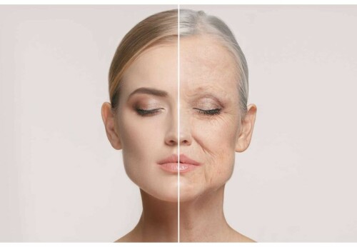 Voir Deep Plane Facelift : lifting cervicofacial à Paris