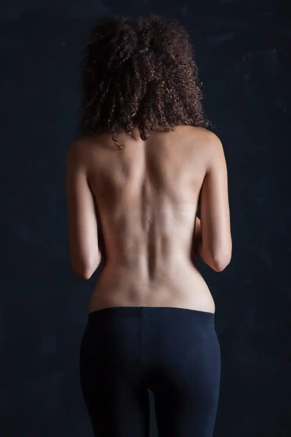 Voir Dermolipectomie circulaire ou bodylift à Paris