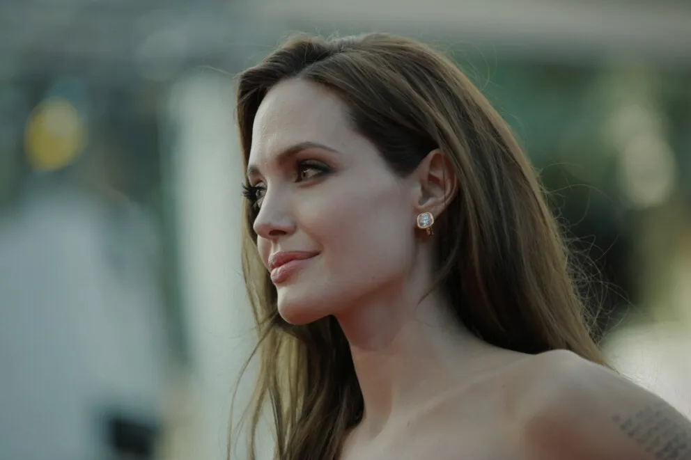 Voir JAWLINE contouring à Paris - injection acide hyaluronique mâchoire
