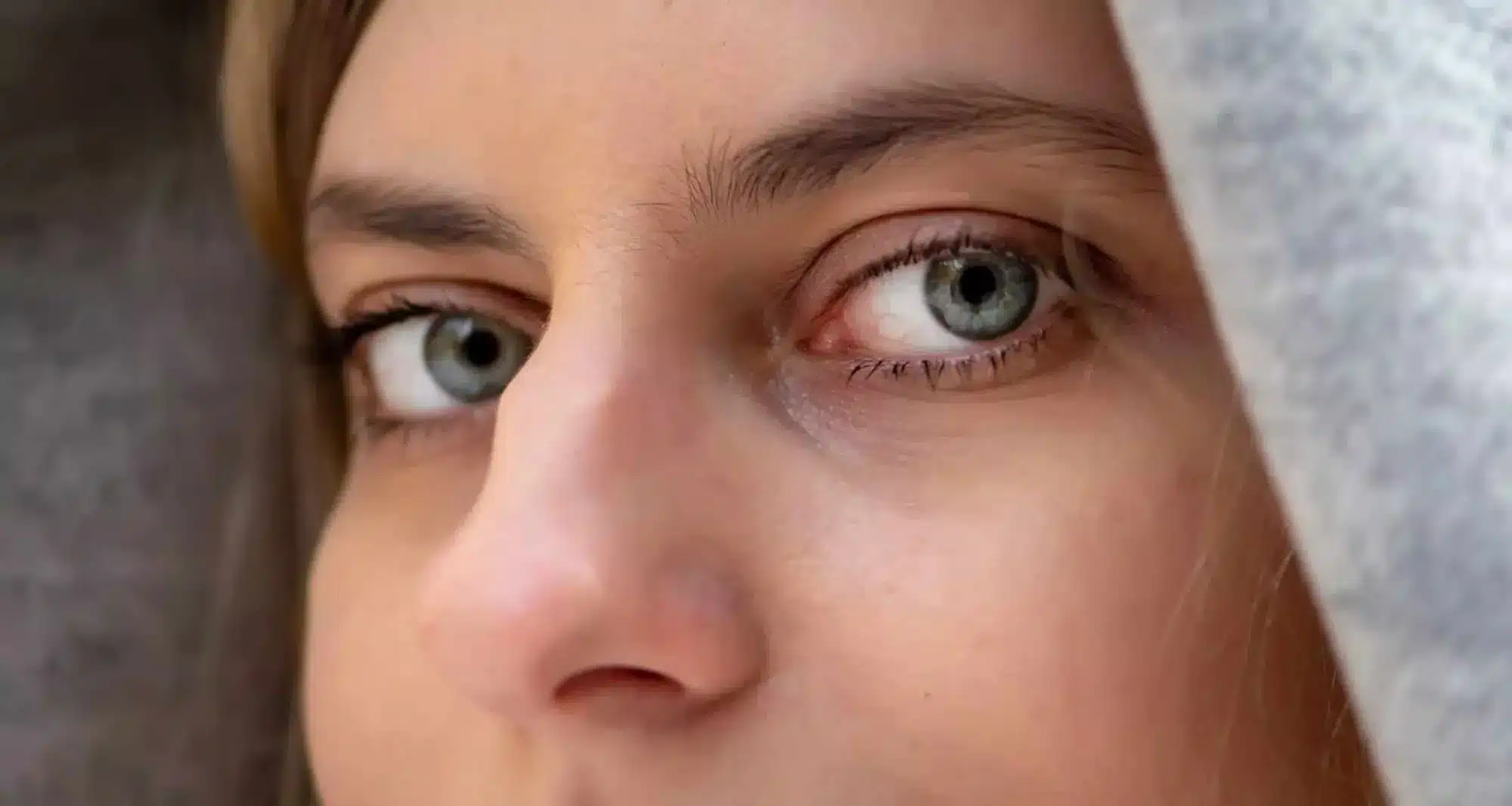 Tout savoir sur la rhinoplastie ultrasonique