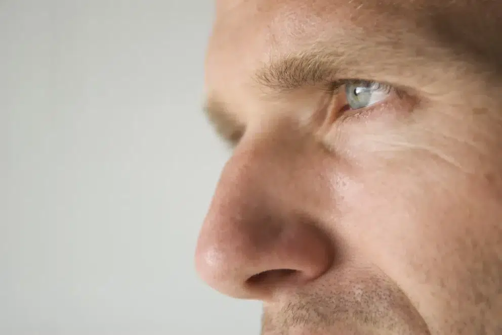 Voir Rhinoplastie à Paris : chirurgie du nez
