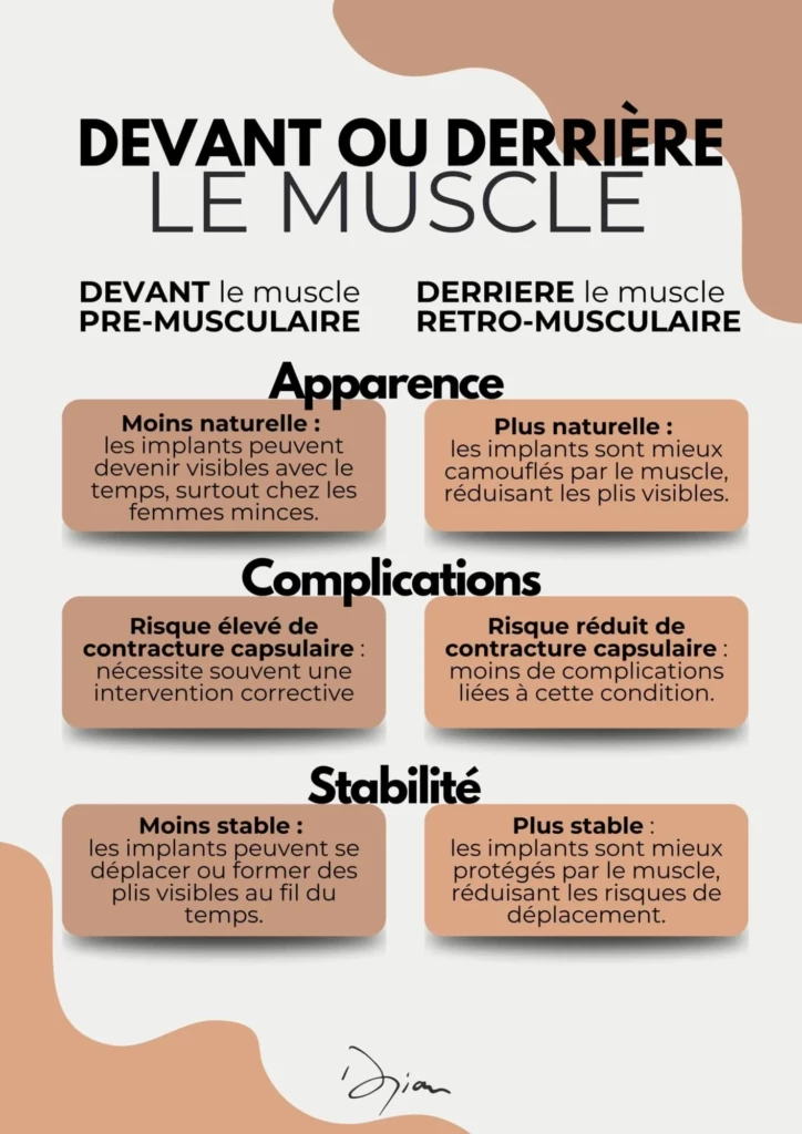 Devant ou derrière le muscle
