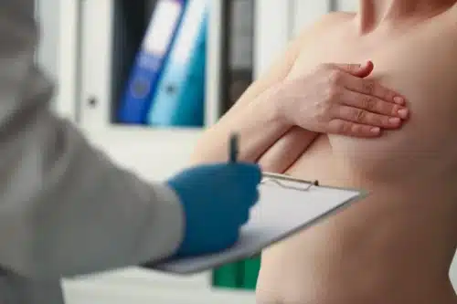 Voir Examens avant une augmentation mammaire, tout savoir