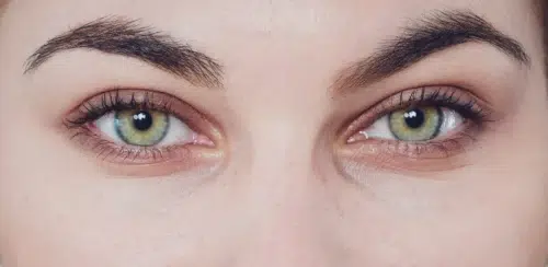 Voir Poches sous les yeux et cernes : quels traitements ?