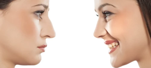 Voir Rhinoplastie prix : combien coûte une chirurgie esthétique du nez ?