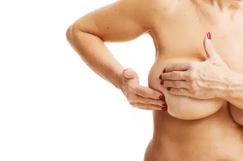 Voir Risque augmentation mammaire : erreurs à éviter pour un résultat optimal