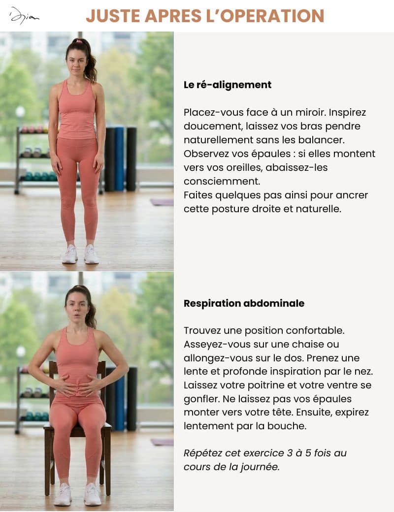 Exercises just after breast augmentation