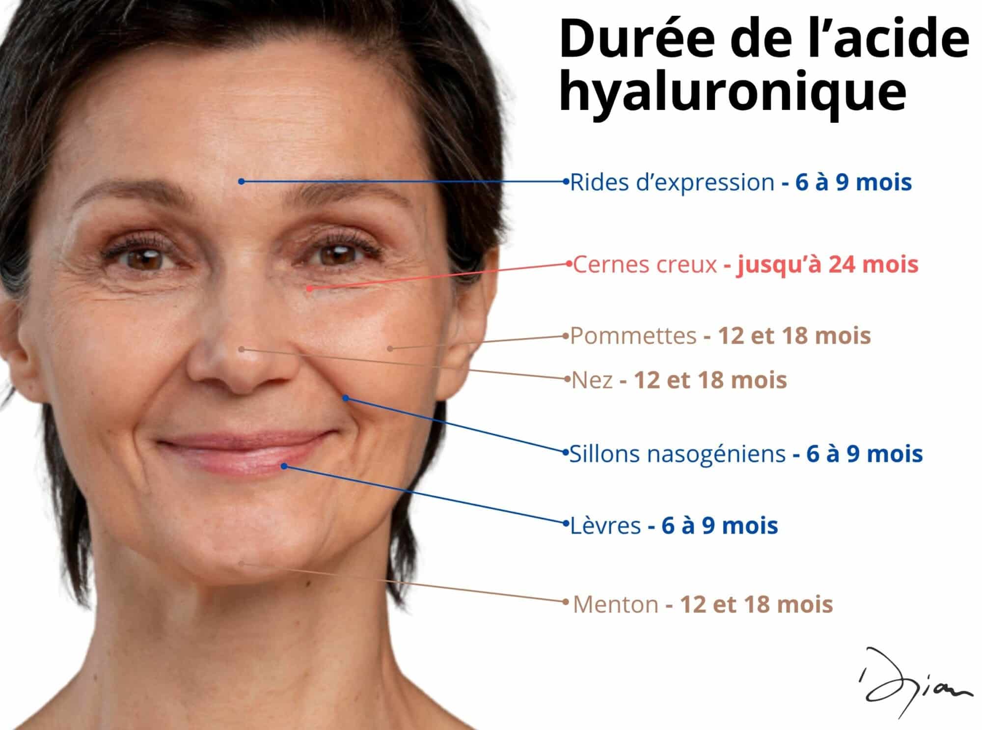 durée de l'acide hyaluronique