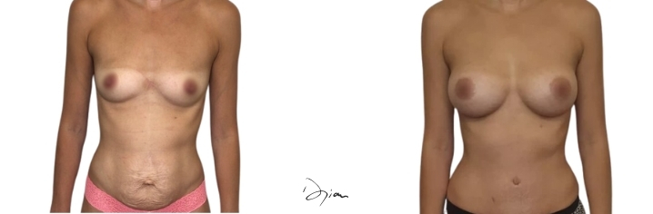 Mommy make over avant après