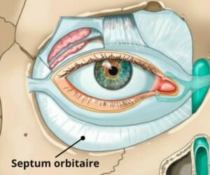 Septum orbitaire