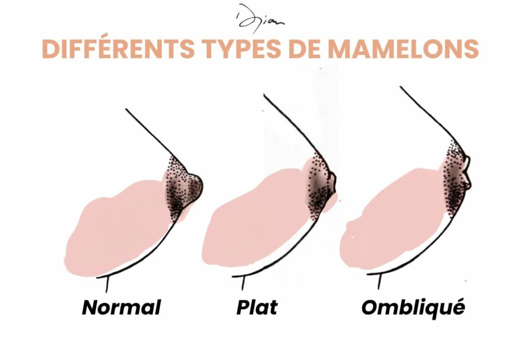 Types de mamelons