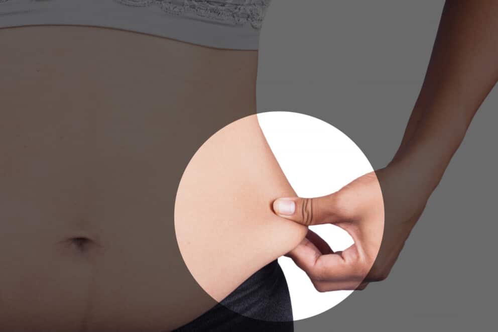 Prix d’une abdominoplastie : coûts réels, variations de tarifs et conditions de remboursement