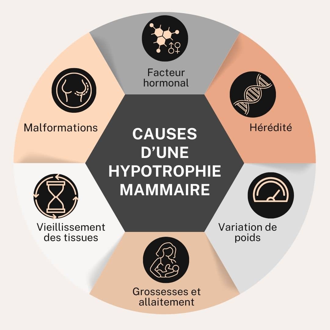 causes hypotrophie mammaire