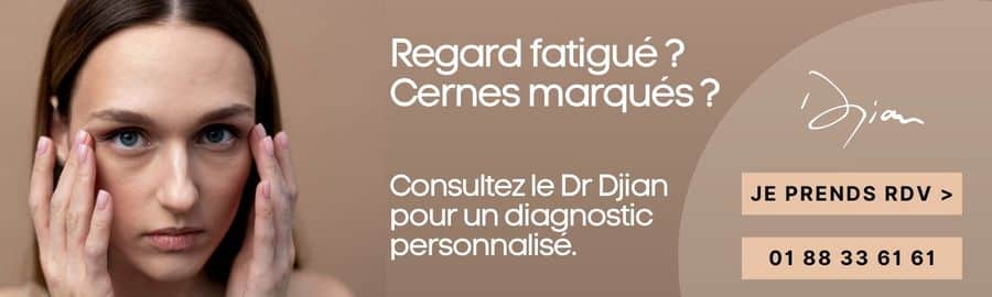 CTA dr djian lipofilling cernes (1)