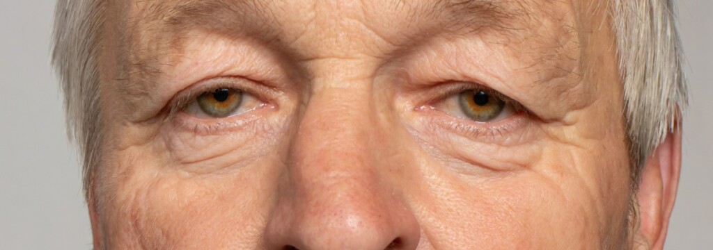 Dermathocholasis Homme