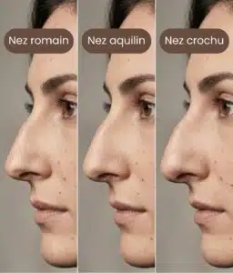 Different types of aquiline nose