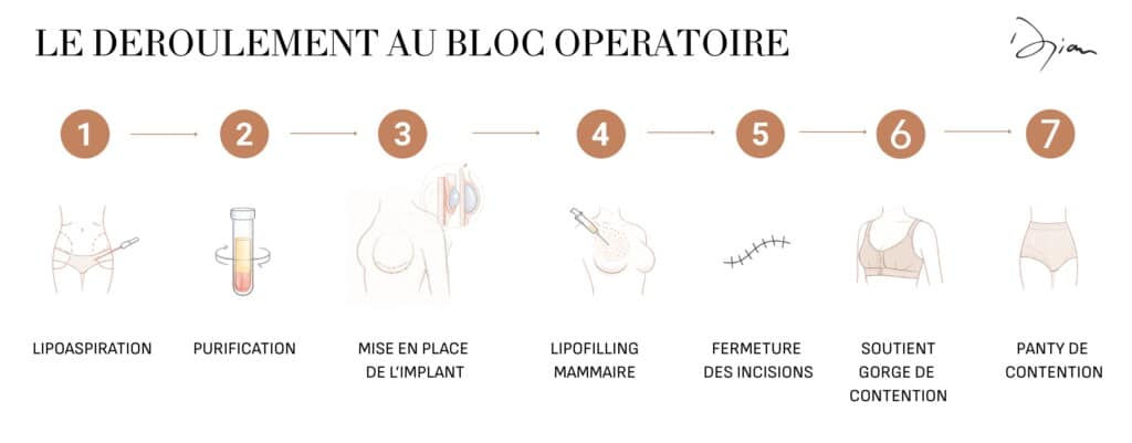 déroulée augmentation mammaire composite