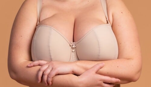Voir Gigantomastie : comprendre, diagnostiquer et traiter cette pathologie rare